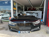 BMW F30 ÖN KAPUT TAMPON SETİ KOMPLE DOLU