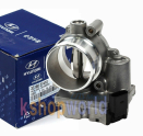 35100-4A000 GAZ KELEBEK GÖVDESİ STAREX CRDİ