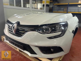 Oto Çıkma Parça / Renault / Megane / Radyatör / Su Radyatörü / Çıkma Parça 