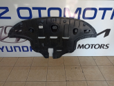 Oto Çıkma Parça / Kia / Sportage / Motor / Alt Muhafaza / Çıkma Parça 